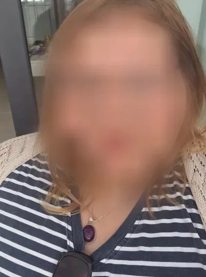 Molly, 23